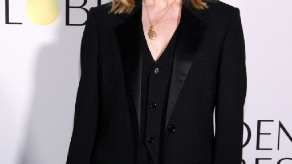 Laura Linney "secou&eacute;e" par son r&ocirc;le dans "Onwards and Sideways" sur la maladie de Parkinson