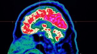 Surging nervous system disorders now top cause of illness: study