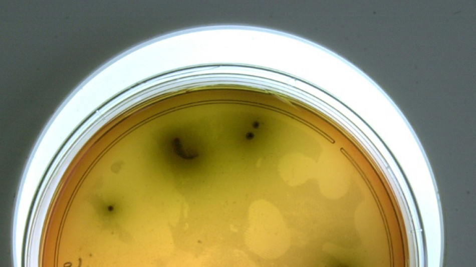 R&uuml;ckruf von Lebensmitteln: Listerien sind h&auml;ufigste Ursache