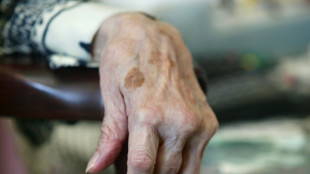 France records growing number of supercentenarians