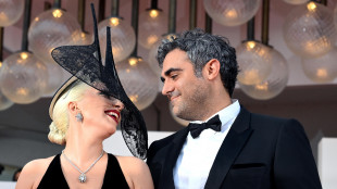 Lady Gaga, la beb&egrave; &egrave; nata con la maternit&agrave; surrogata