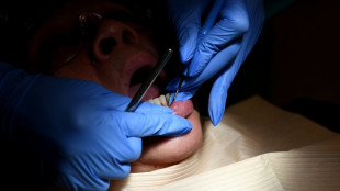 Caries dentaires: la Haute autorité de santé recommande le remboursement de quatre traitements