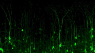 Sla, scoperto il meccanismo che compromette l'equilibrio dei neuroni motori