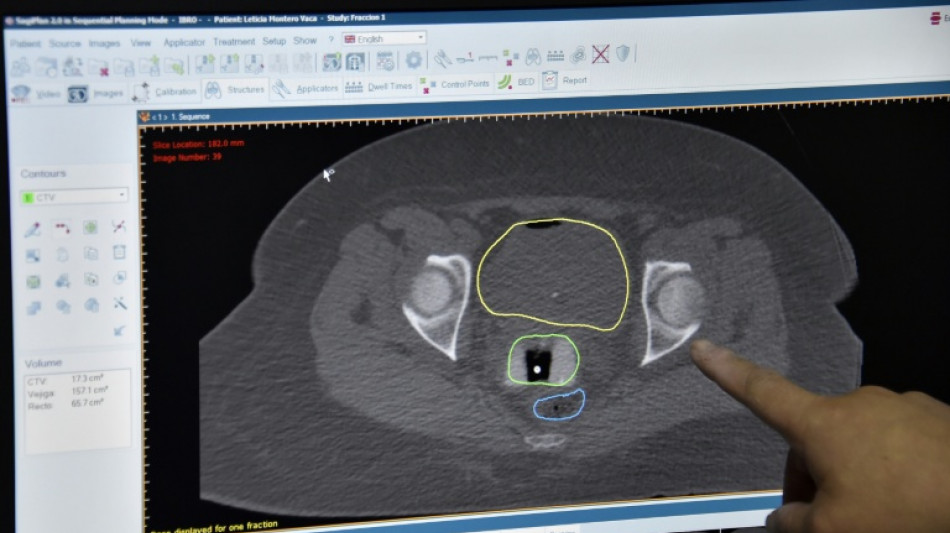 New cancer plan urged as survival improvements in England slow
