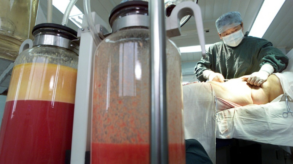 Inician una investigación en Turquía por la muerte de una "influencer" brasileña en una liposucción