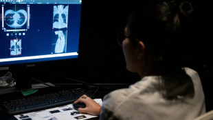 Sant&eacute; et pr&eacute;vention: l'essor des check-up priv&eacute;s soul&egrave;ve des inqui&eacute;tudes