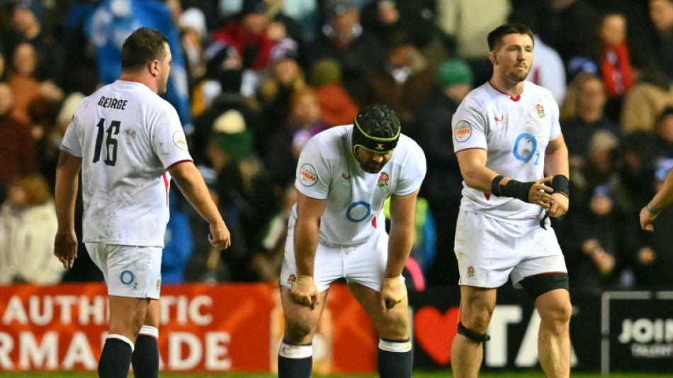 Oh! Calcutta! -- how did England lose to Scotland in Six Nations?
