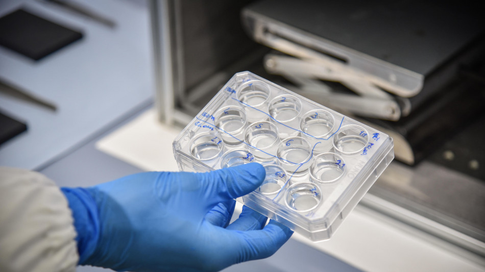 Organoidi stampati in 3D per la medicina su misura del futuro